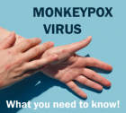 NYC Now EPICENTER of MONKEYPOX EPIDEMIC - What You Need To Know